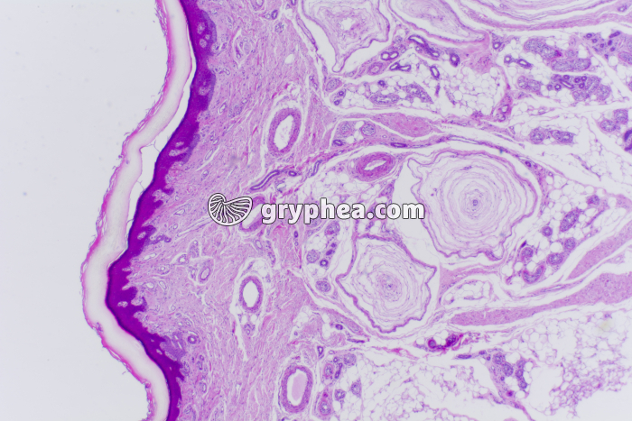 Peau du doigt avec corpuscules de Pacini x10 - gryphea.org